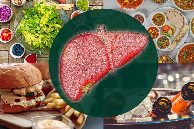 Liver Disease Nutrition